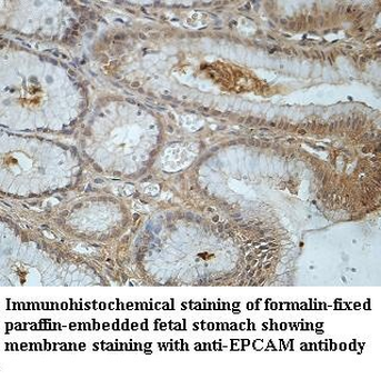 EpCAM Rabbit Polyclonal Antibody