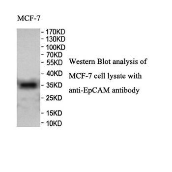 EpCAM Rabbit Polyclonal Antibody