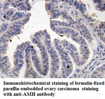AMH Rabbit Polyclonal Antibody