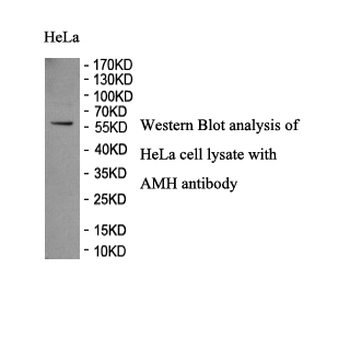 AMH Rabbit Polyclonal Antibody