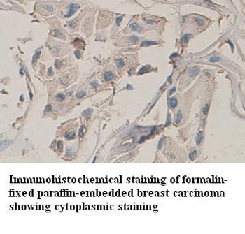 AMPK1 Rabbit Polyclonal Antibody