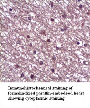 ANG1 Rabbit Polyclonal Antibody