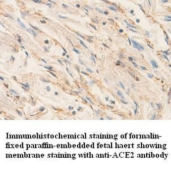 ACE2 Rabbit Polyclonal Antibody