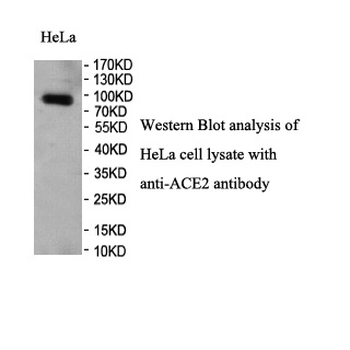 ACE2 Rabbit Polyclonal Antibody