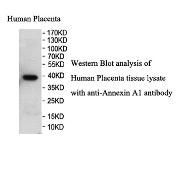 Annexin A1 Rabbit Polyclonal Antibody