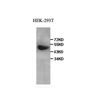 AP-2 gamma Rabbit Polyclonal Antibody