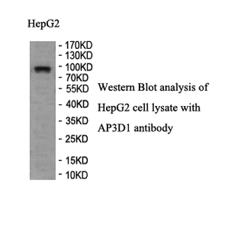 AP3 Rabbit Polyclonal Antibody