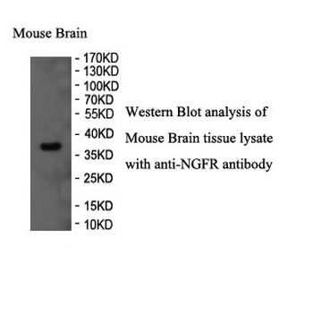 NGFR Rabbit Polyclonal Antibody