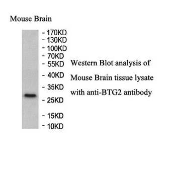 BTG2 Rabbit Polyclonal Antibody