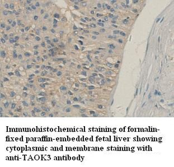 TAOK3 Rabbit Polyclonal Antibody