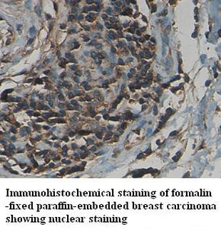 Nucleophosmin Rabbit Polyclonal Antibody