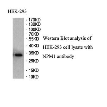 Nucleophosmin Rabbit Polyclonal Antibody