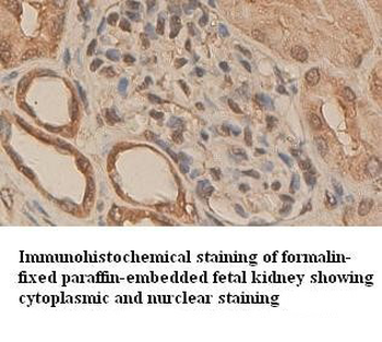 RAR alpha Rabbit Polyclonal Antibody