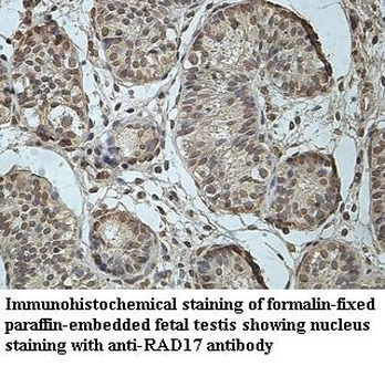 RAD17 Rabbit Polyclonal Antibody