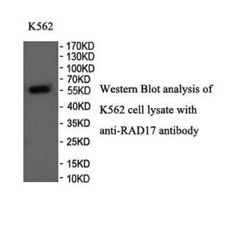 RAD17 Rabbit Polyclonal Antibody