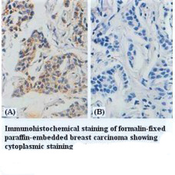 Hsp60 Rabbit Polyclonal Antibody