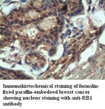 RB1 Rabbit Polyclonal Antibody