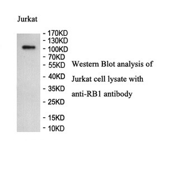 RB1 Rabbit Polyclonal Antibody