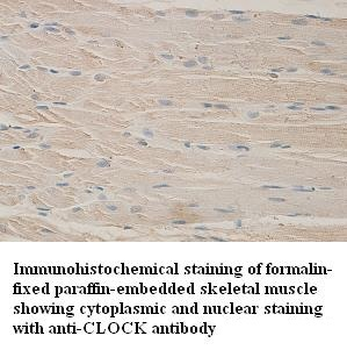 CLOCK Rabbit Polyclonal Antibody