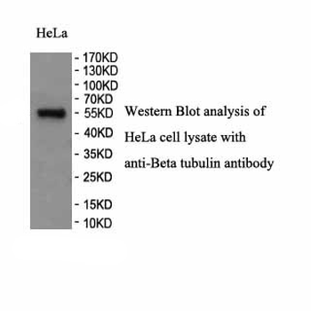 TUBB Rabbit Polyclonal Antibody