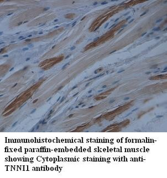 TNNI1 Rabbit Polyclonal Antibody