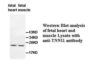 TNNI1 Rabbit Polyclonal Antibody