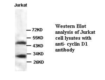 Cyclin D1 Rabbit Polyclonal Antibody