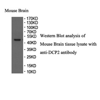 DCP2 Rabbit Polyclonal Antibody