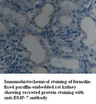 BMP-7 Rabbit Polyclonal Antibody