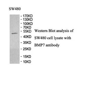 BMP-7 Rabbit Polyclonal Antibody