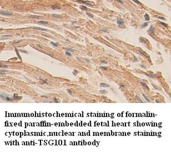 TSG101 Rabbit Polyclonal Antibody