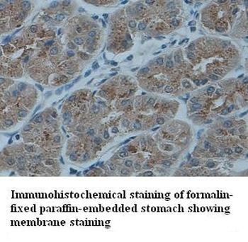 RON Rabbit Polyclonal Antibody