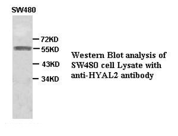 HYAL2 Rabbit Polyclonal Antibody