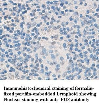 FUS Rabbit Polyclonal Antibody