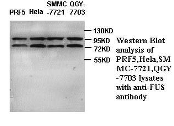 FUS Rabbit Polyclonal Antibody