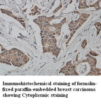 Keratin 7 Rabbit Polyclonal Antibody