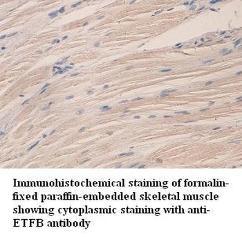 ETFB Rabbit Polyclonal Antibody