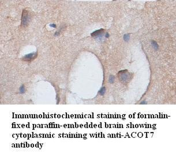 ACOT7 Rabbit Polyclonal Antibody