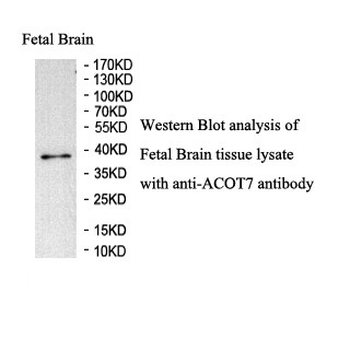ACOT7 Rabbit Polyclonal Antibody