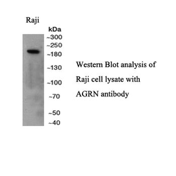 AGRN Rabbit Polyclonal Antibody