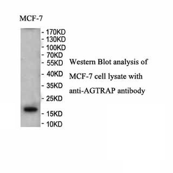 AGTRAP Rabbit Polyclonal Antibody