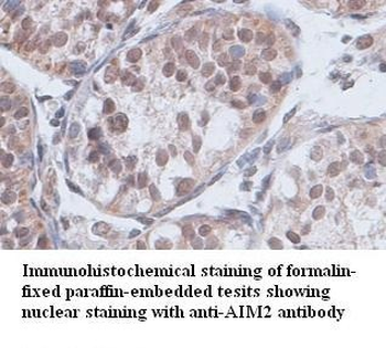 AIM2 Rabbit Polyclonal Antibody