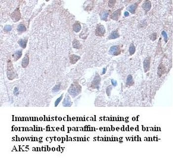 AK5 Rabbit Polyclonal Antibody