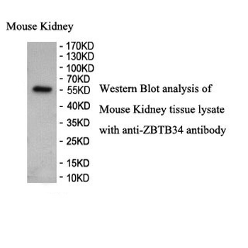 ZBTB34 Rabbit Polyclonal Antibody