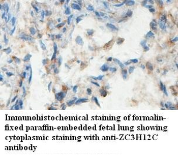 ZC3H12C Rabbit Polyclonal Antibody