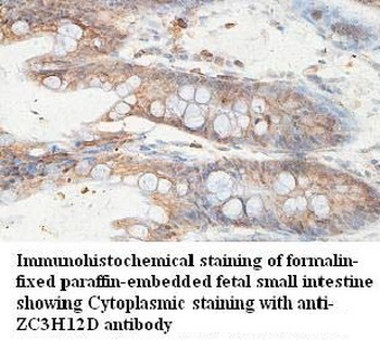 ZC3H12D Rabbit Polyclonal Antibody