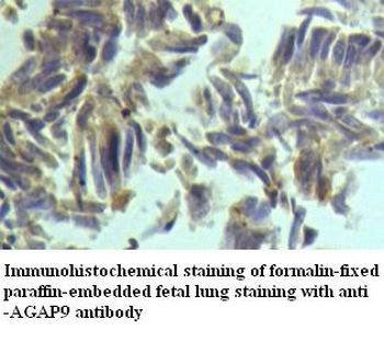 AGAP9 Rabbit Polyclonal Antibody
