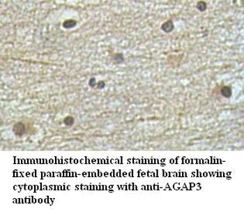 AGAP3 Rabbit Polyclonal Antibody
