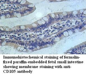 ENG Rabbit Polyclonal Antibody