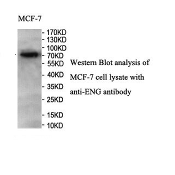 ENG Rabbit Polyclonal Antibody